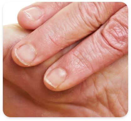 Njihni fototipin e lekures suaj